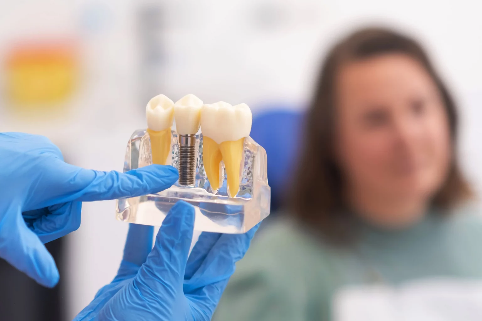 ¿Duelen los implantes dentales? Lo que ocurre de verdad antes, durante y después