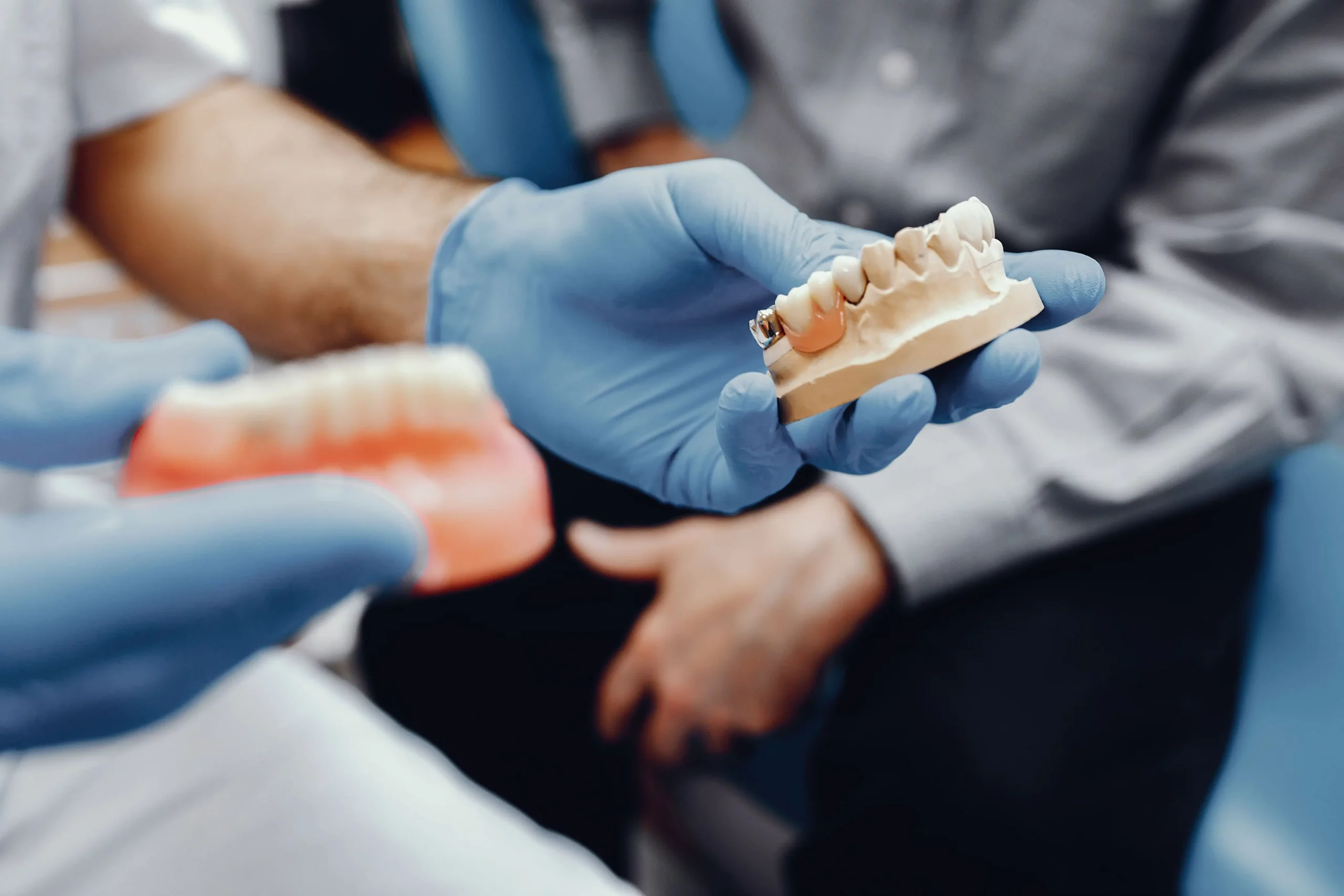 Cuidados tras la colocación de un implante dental guía paso a paso en valencia amedent