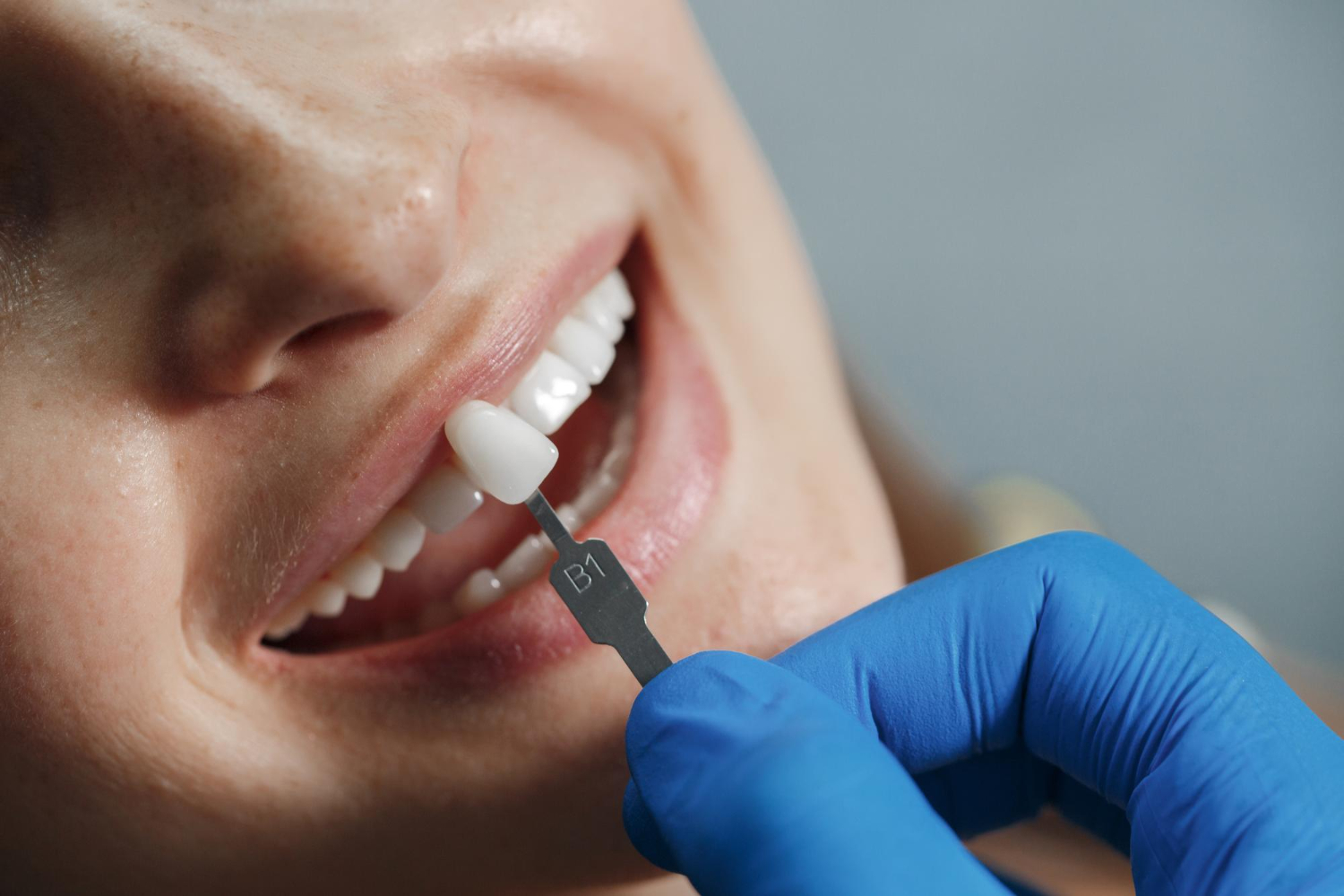Amedent - Clínica Dental en Valencia|Prótesis dentales fijas: Tipos y Ventajas