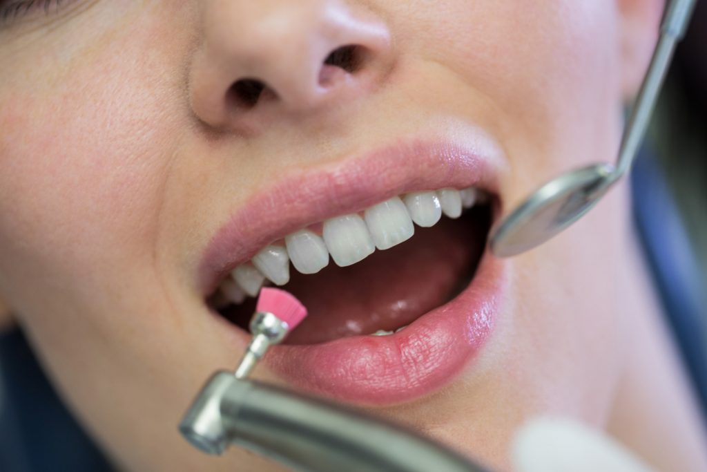 Amedent - Clínica Dental en Valencia|Biopelícula: El culpable secreto de la placa dental y cómo prevenirla