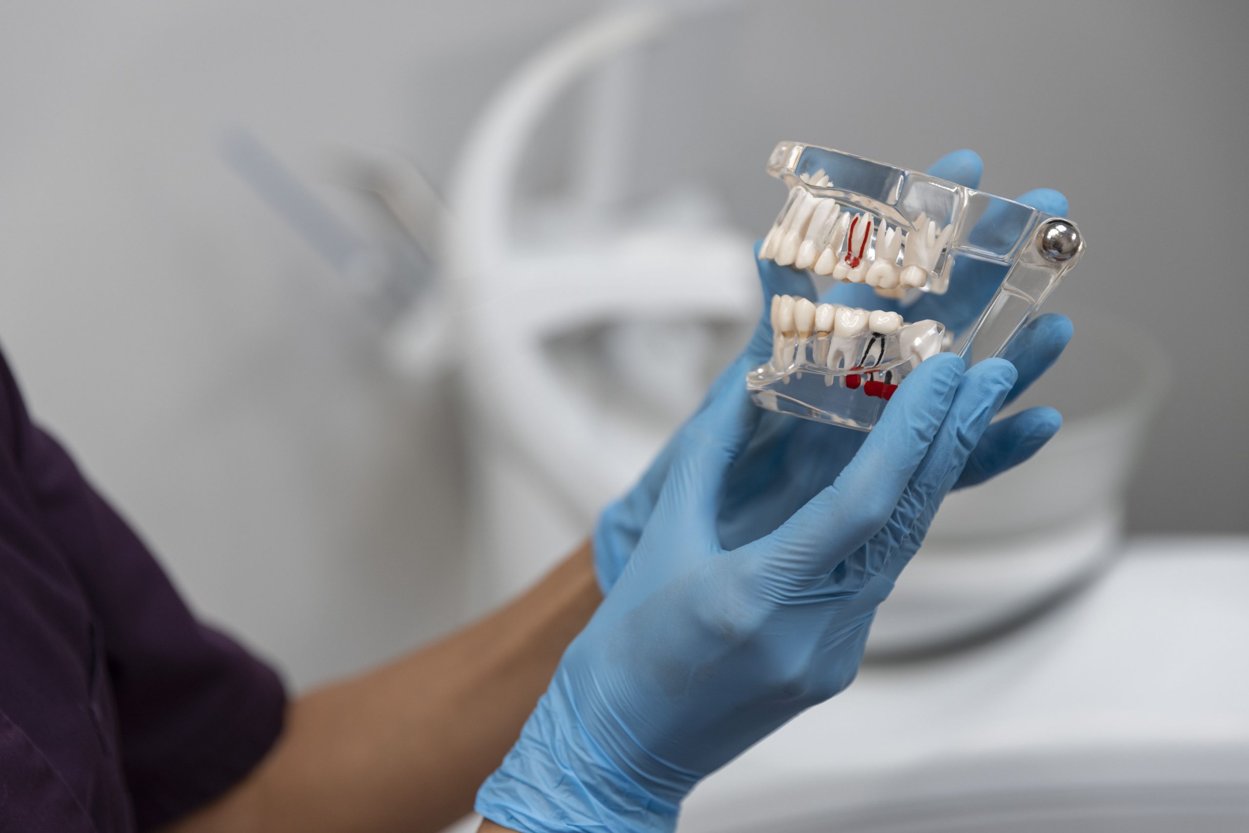Implantólogo de sujetando maqueta de implante dental, mostrando el proceso de osteointegración y colocación de implantes dentales Valencia.