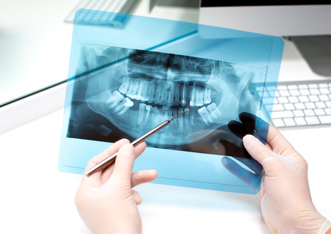 Amedent - Clínica Dental en Valencia|Tratamientos Dentales